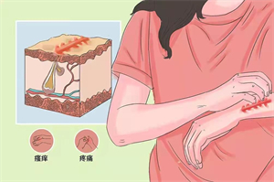 太原去傷疤增生哪家好