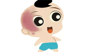 太原激光胎記在哪里