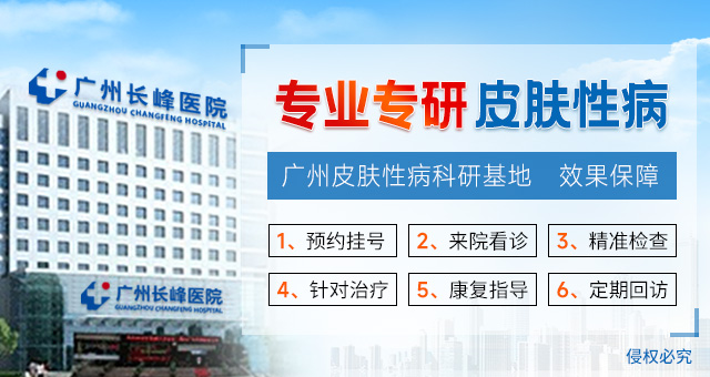 廣州看hpv醫(yī)院哪家好?_廣州治hpv的專門醫(yī)院重點(diǎn)排名
